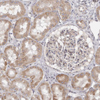 Anti-TIMM17B Antibody