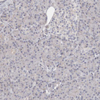 Anti-TIMM17B Antibody