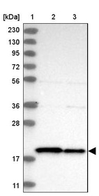 Anti-TIMM17B Antibody