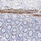 Anti-GLMP Antibody