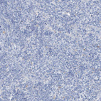 Anti-GLMP Antibody