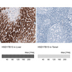 Anti-HSD17B13 Antibody