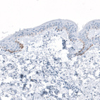 Anti-HSD17B13 Antibody