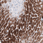 Anti-HSD17B13 Antibody