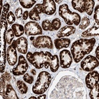 Anti-CST9 Antibody