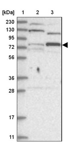 Lane 1: Marker [kDa] 230, 130, 95, 72, 56, 36, 28, 17, 11_br/_Lane 2: Human cell line RT-4_br/_Lane 3: Human cell line U-251MG sp