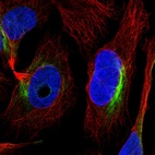 Anti-ZNF557 Antibody