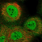 Immunofluorescent staining of human cell line A-431 shows localization to nucleoplasm, plasma membrane & cytosol.