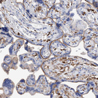 Anti-MS4A4A Antibody