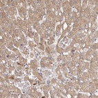 Anti-ETNK1 Antibody