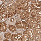 Anti-FAM180B Antibody