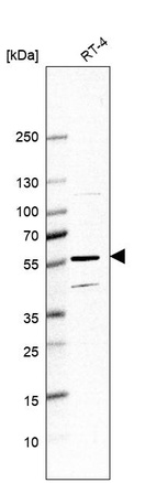 Western blot analysis in human cell line RT-4.