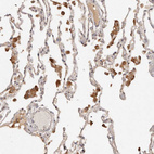 Anti-KIAA1147 Antibody