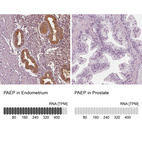 Anti-PAEP Antibody