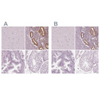 Anti-PAEP Antibody