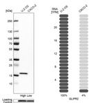 Anti-GLIPR2 Antibody