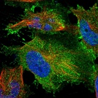 Anti-TYW3 Antibody