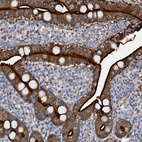 Anti-MDN1 Antibody