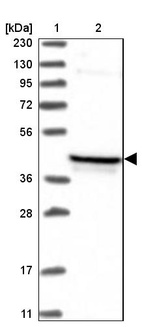 Anti-PDSS2 Antibody