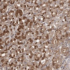 Anti-PDSS2 Antibody