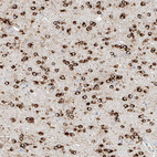 Anti-MAP7 Antibody