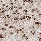 Anti-MAP7 Antibody