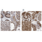 Anti-RAD23B Antibody