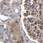 Anti-RAD23B Antibody