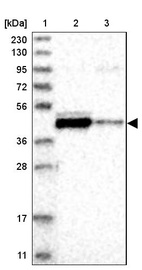 Anti-MTFR2 Antibody