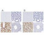 Anti-LALBA Antibody