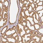 Anti-LALBA Antibody