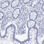 Anti-LALBA Antibody