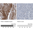 Anti-PLEC Antibody