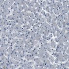 Anti-PLEC Antibody