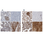 Anti-PLEC Antibody