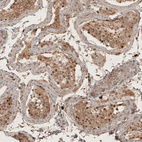 Anti-RECQL5 Antibody