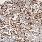 Immunohistochemical staining of human placenta shows moderate to strong nuclear positivity in trophoblastic cells.