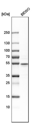 Anti-CRISPLD2 Antibody