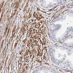 Anti-LMOD1 Antibody