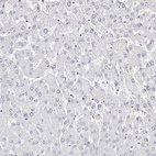 Anti-LMOD1 Antibody