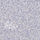 Anti-LMOD1 Antibody