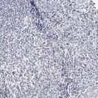 Anti-LMOD1 Antibody