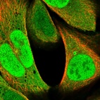 Anti-RNF187 Antibody