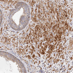 Anti-GBP4 Antibody