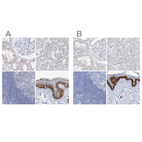 Anti-FRS3 Antibody