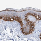 Anti-FRS3 Antibody