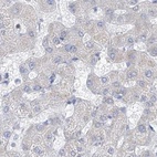 Anti-FRS3 Antibody