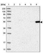 Anti-FRS3 Antibody