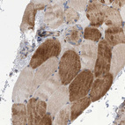 Anti-TJAP1 Antibody