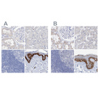 Anti-FRS3 Antibody